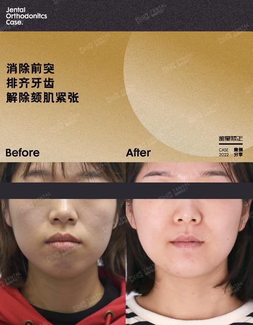 周博士牙齿矫正-图1