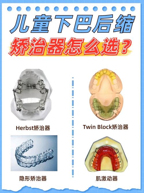 矫正牙齿器品种有哪些？常见类型有何区别？-图2