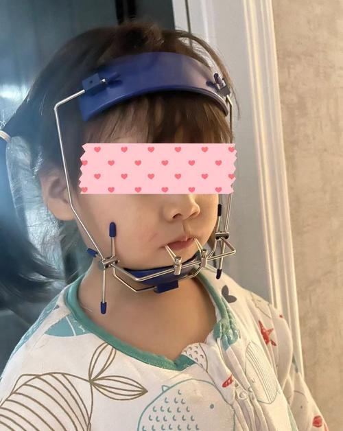 上地牙齿矫正哪家好？怎么选医院医生才靠谱？-图2