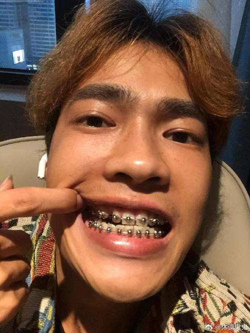 苏州牙齿矫正，如何选择靠谱机构与方案？-图1