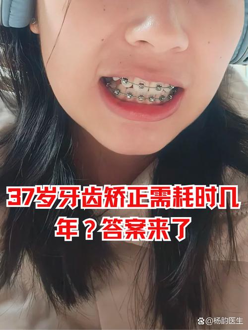 安徽牙齿矫正效果怎么样？医院怎么选？-图1