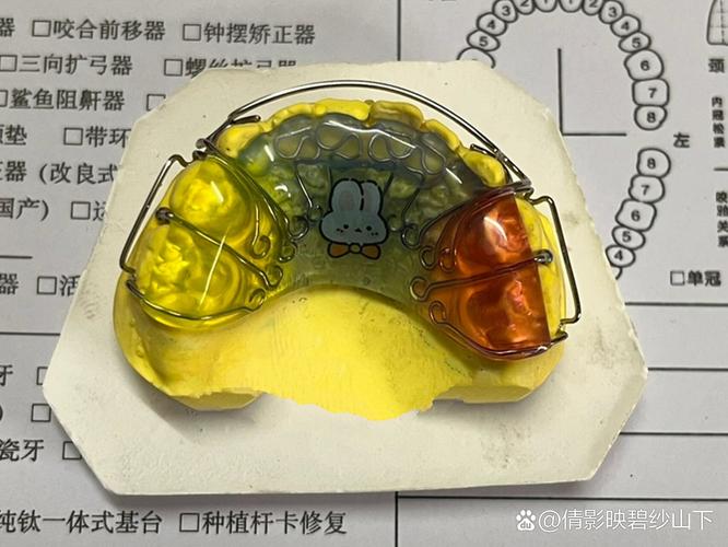 牙齿反合矫正器效果如何？适用哪些人群？-图2