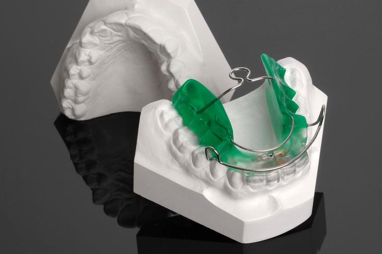 矫正牙齿的斜导是什么？能解决哪些咬合问题？-图3