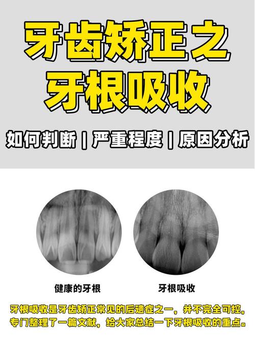 牙齿矫正牙根发痒，是牙齿移动的正常反应吗？-图2