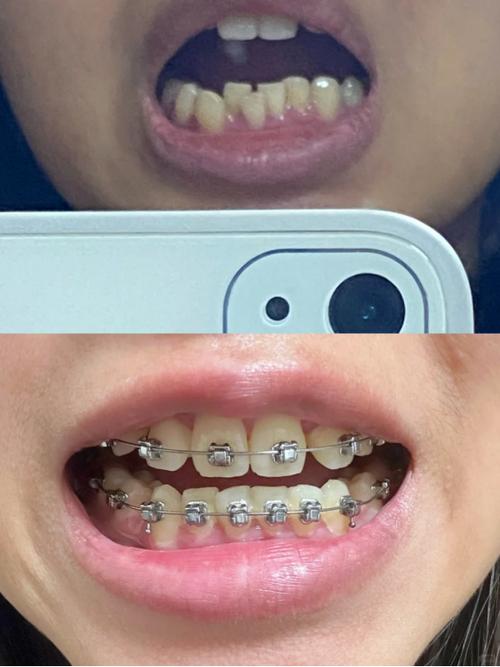 矫正牙齿交流群-图2