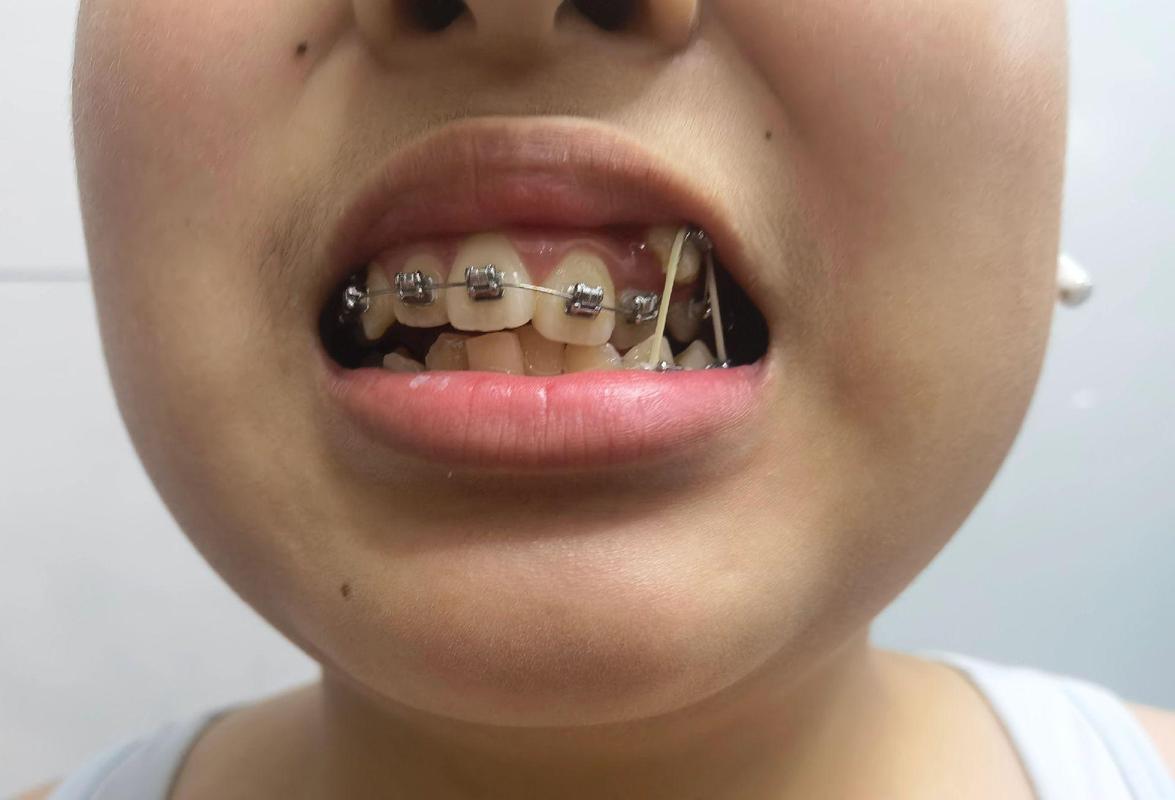 常熟市牙齿矫正-图2