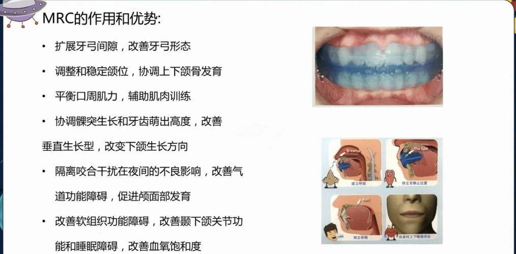 牙齿矫正器构造-图1 牙齿矫正器构造-图1
