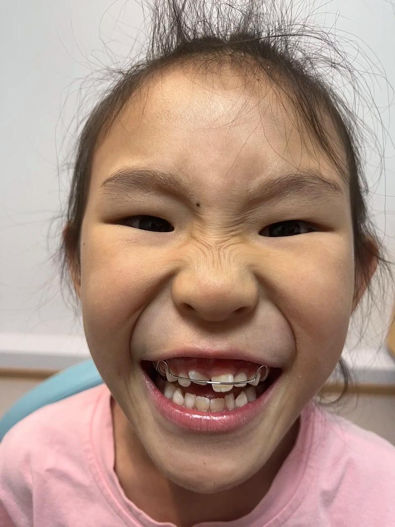 牙齿矫正能让人变美？效果到底靠不靠谱？-图1