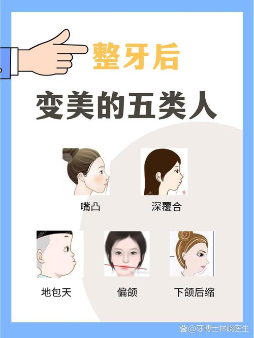 牙齿矫正能让人变美？效果到底靠不靠谱？-图3