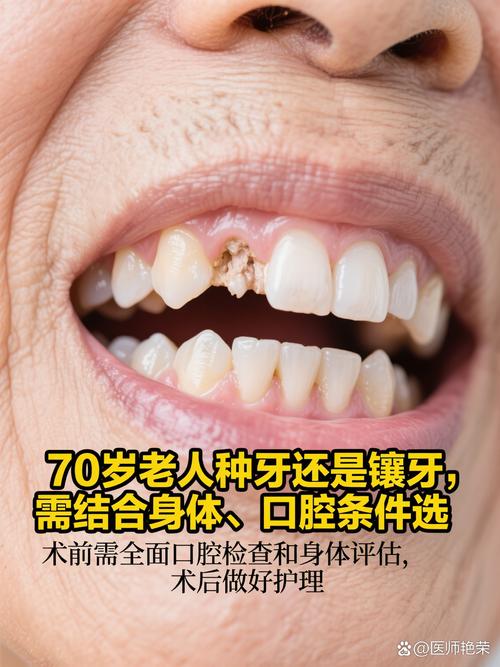 中年矫正牙齿来得及吗？效果会受年龄影响吗？-图3
