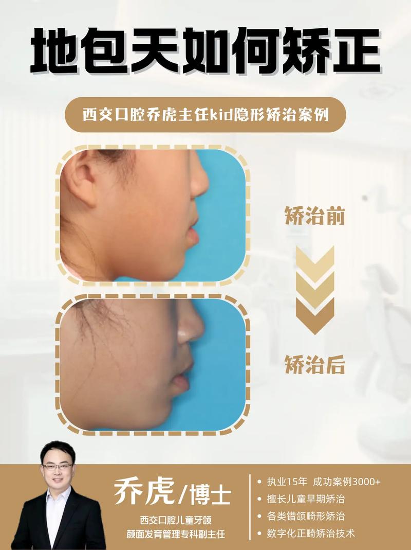 爆牙齿如何矫正-图2