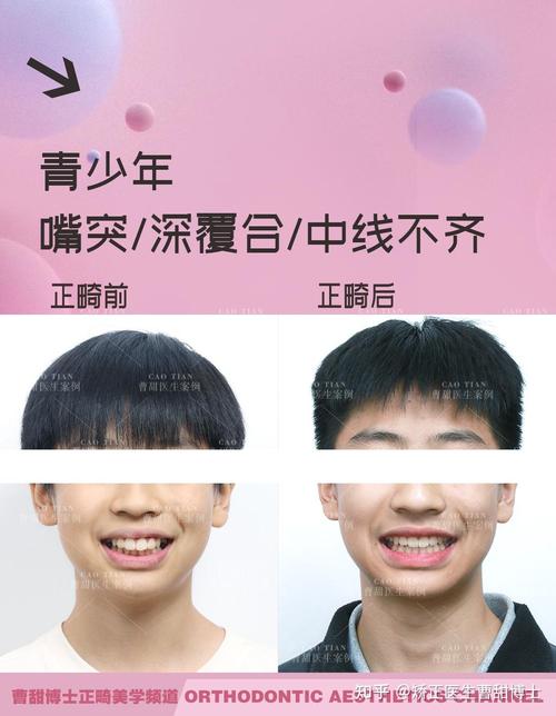 西安整牙齿矫正，如何选择靠谱医院？-图1