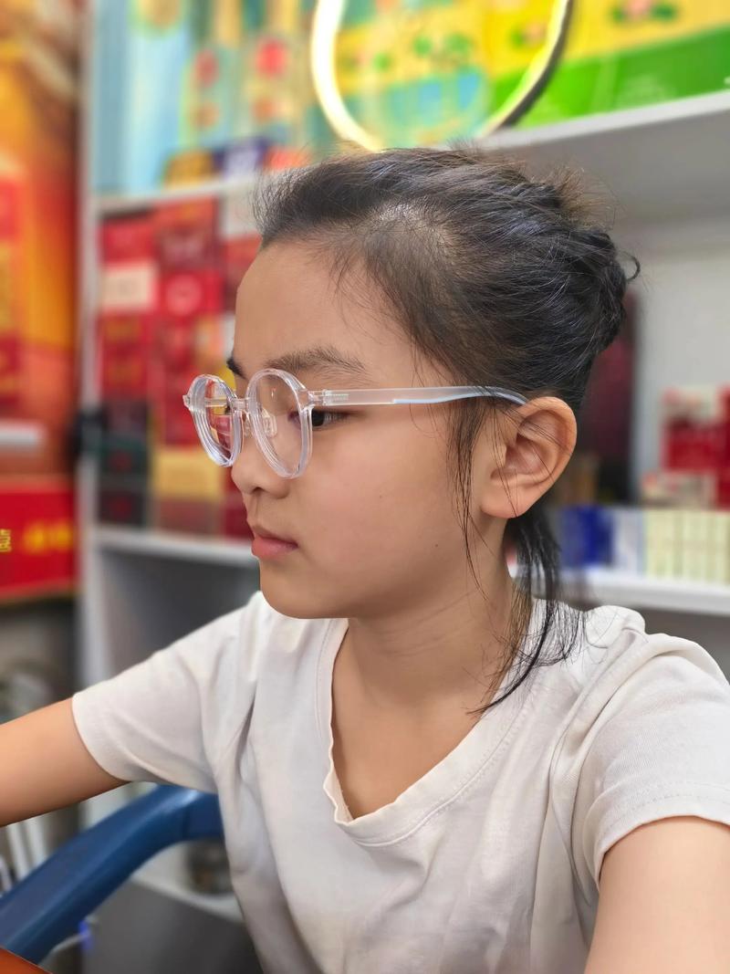 牙齿矫正3个月,矫正效果和变化如何?-图2 牙齿矫正3个月,矫正效果和变化如何?-图2