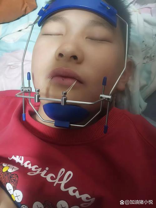 郑州牙齿矫正怎么选?医院靠谱、价格效果如何?-图3 郑州牙齿矫正怎么选?医院靠谱、价格效果如何?-图3