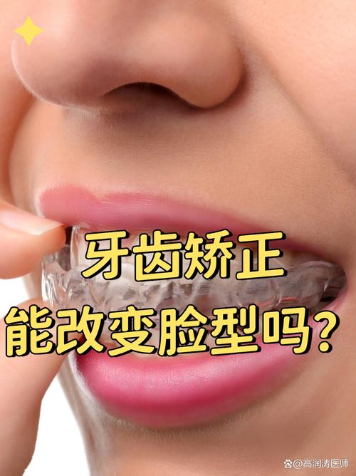 矫正牙齿脸变尖-图2