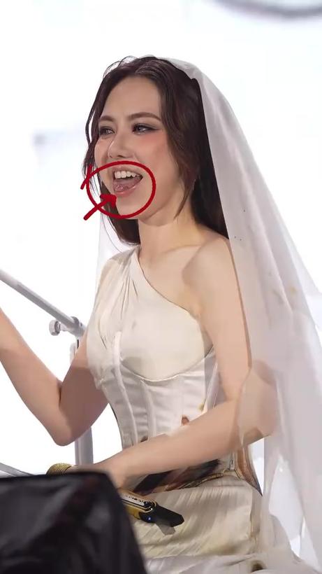 邓紫棋牙齿矫正引发热议，矫正前后变化有多大？-图2