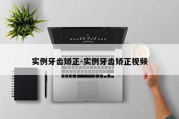 实例牙齿矫正-实例牙齿矫正视频-图1 实例牙齿矫正-实例牙齿矫正视频-图1