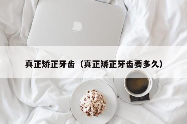 真正矫正牙齿(真正矫正牙齿要多久)-图1 真正矫正牙齿(真正矫正牙齿要多久)-图1
